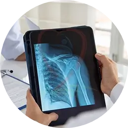 exame de raio x do ombro sendo analisado por médico